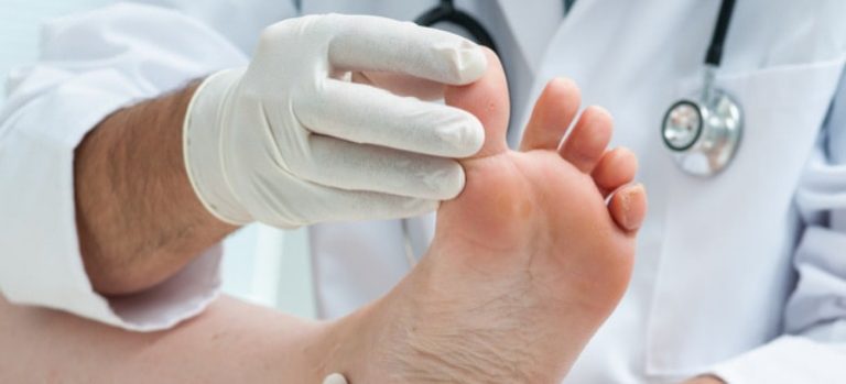How to Tell the Difference Between a Sprained Toe and Broken Toe